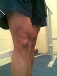 09-knee2