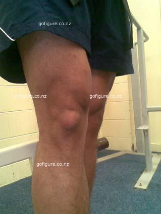 09-knee2