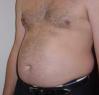 beerbelly