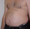 beerbelly