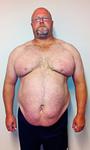 00-Cath-Brycebefore2-small.jpg
