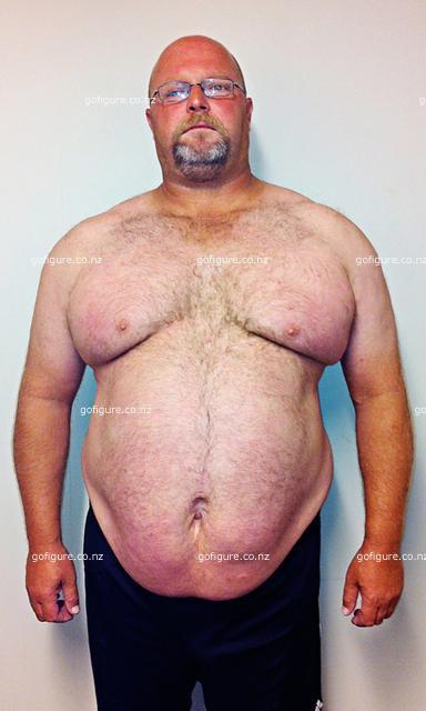 00-Cath-Brycebefore2-small.jpg