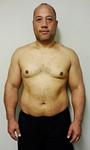 00-Cath-Filobefore2-small.jpg