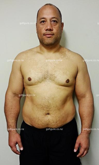 00-Cath-Filobefore2-small.jpg