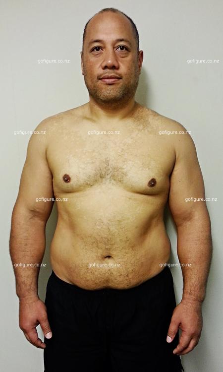 00-Cath-Filobefore2-small.jpg